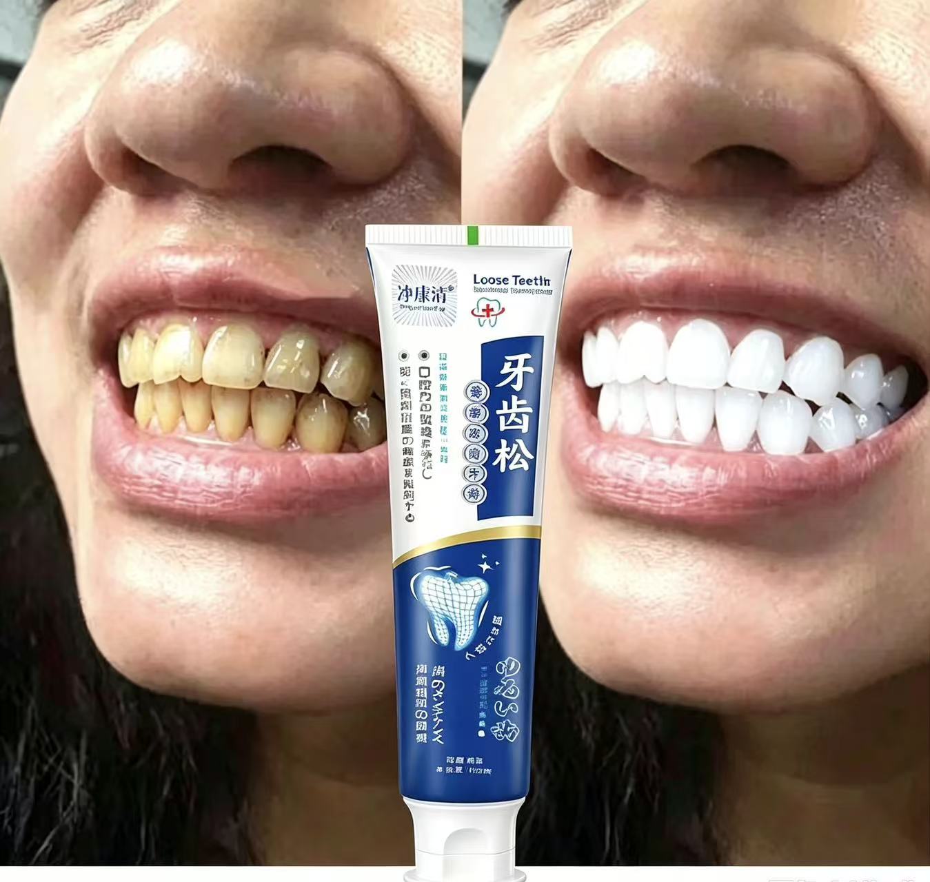 Teeth Whitening Japanese - Dentifrice Japonais Importé pour Dents Dégarnies