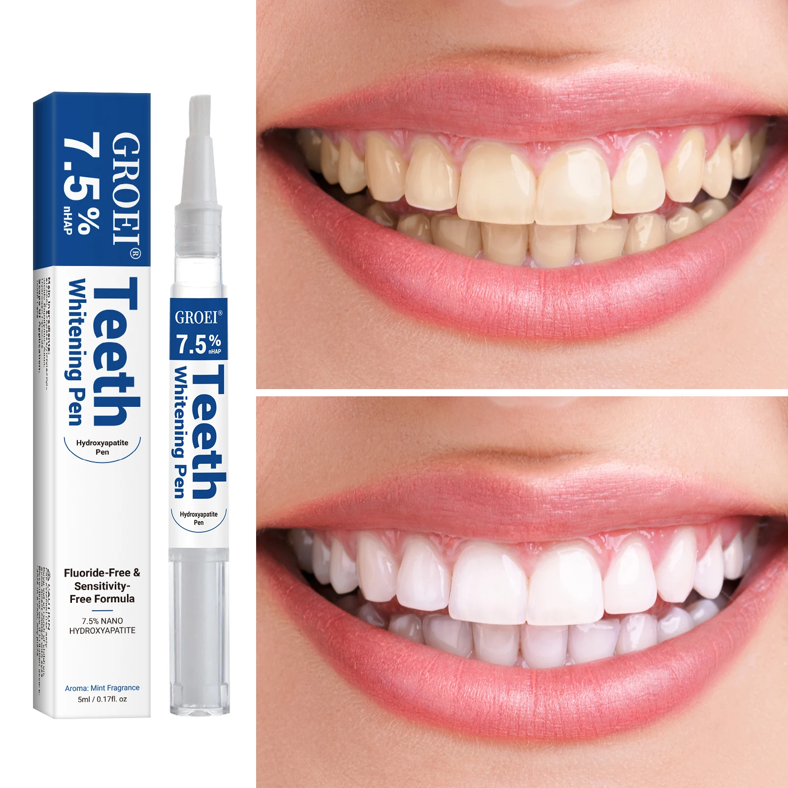 Stylo de blanchiment des dents - Teeth Whitening Before And After avis et prix