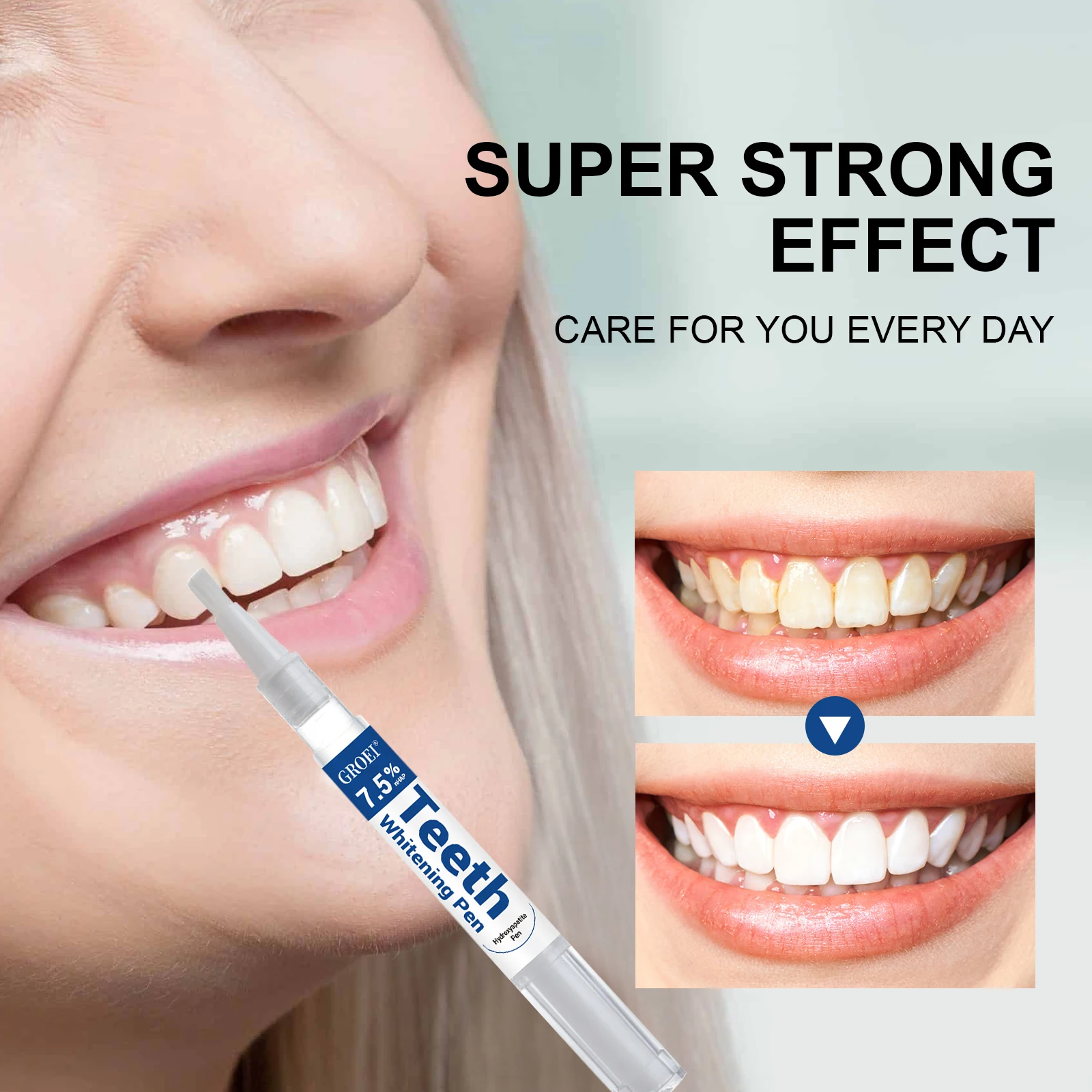 Stylo de blanchiment des dents - Teeth Whitening Before And After avis et prix