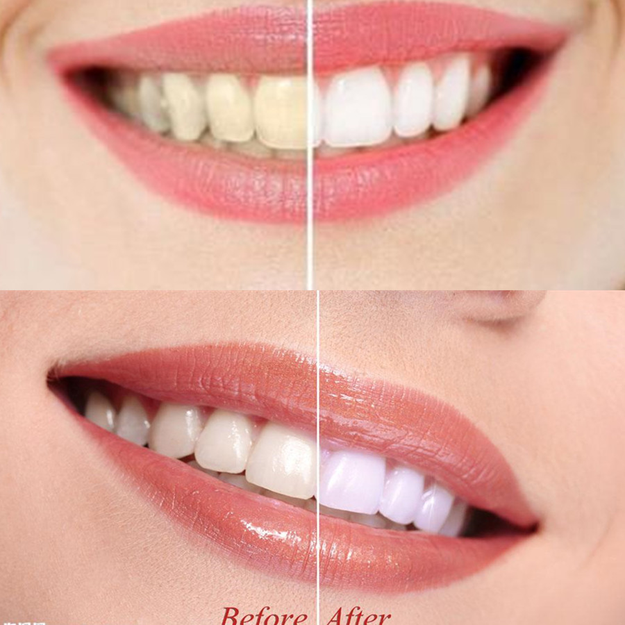 Poudre de charbon de bambou po - Teeth Whitening Co avis et prix