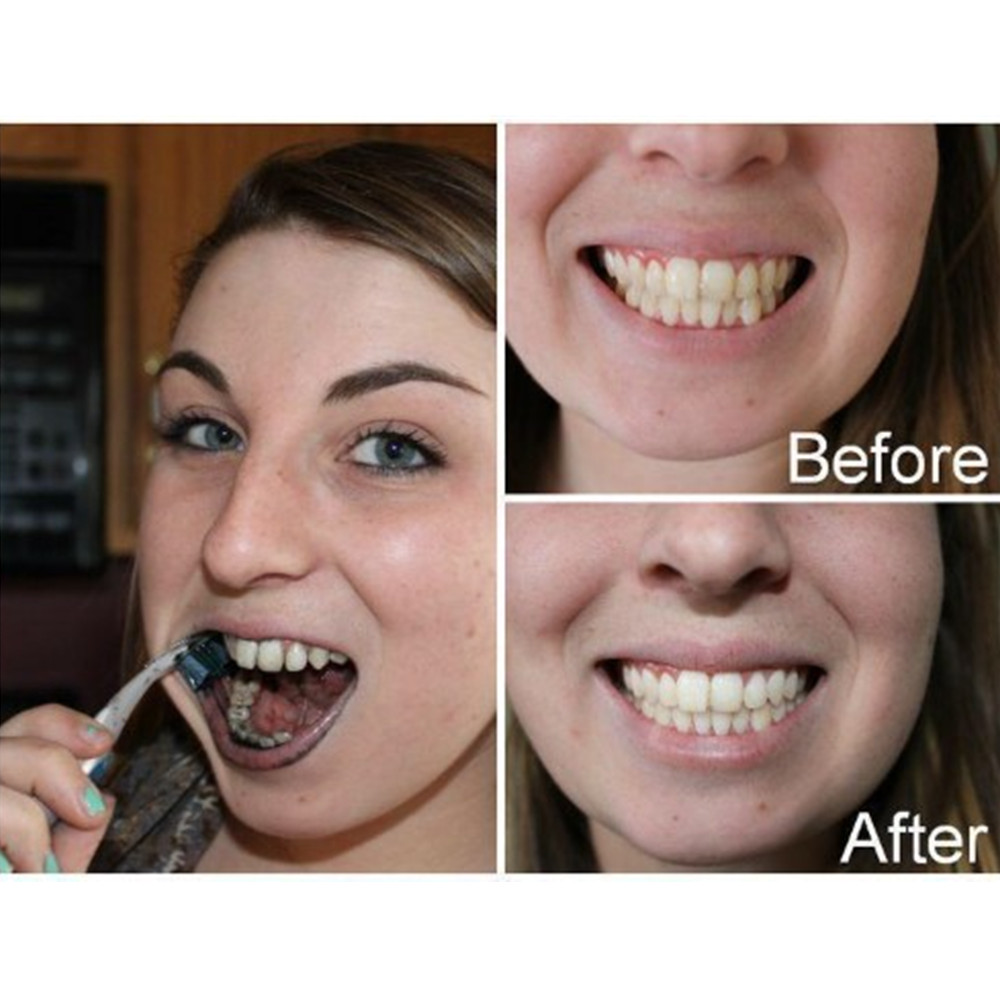 Poudre de charbon de bambou po - Teeth Whitening Co avis et prix