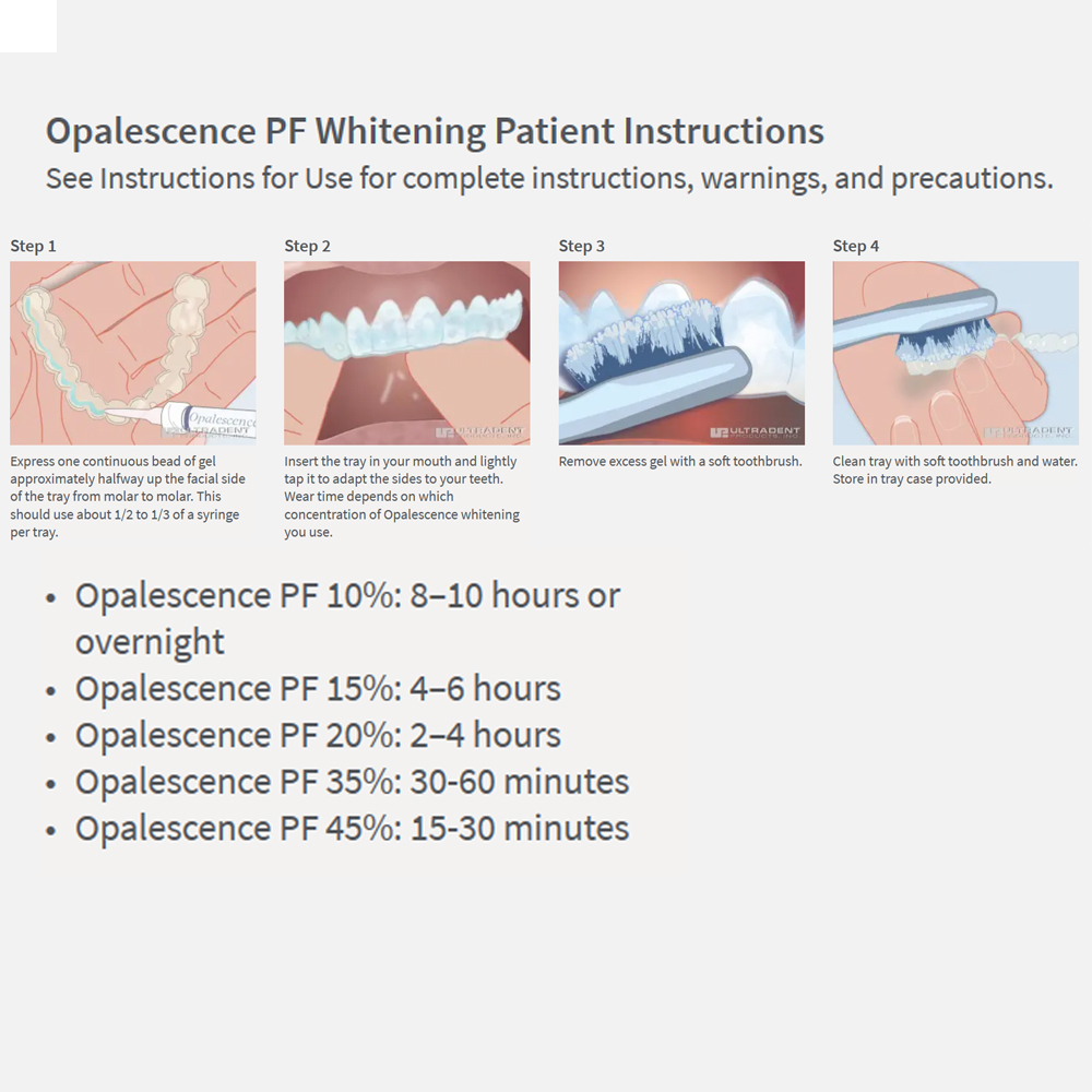 Opalwisdom-Kit de Blanchiment  - Teeth Whitening Before And After avis et prix