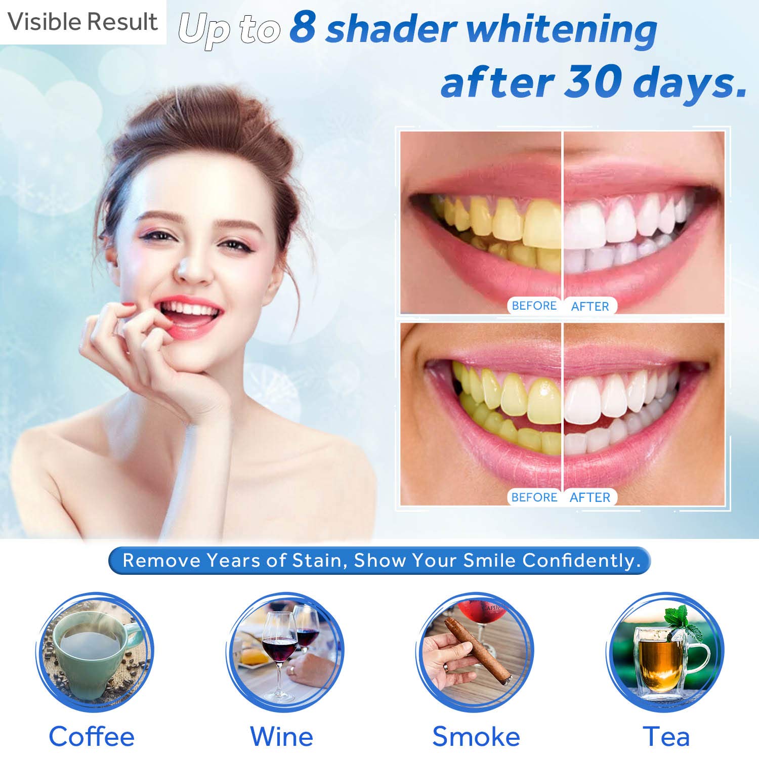 Gel de blanchiment des dents r - Teeth Whitening Gel Refills avis et prix
