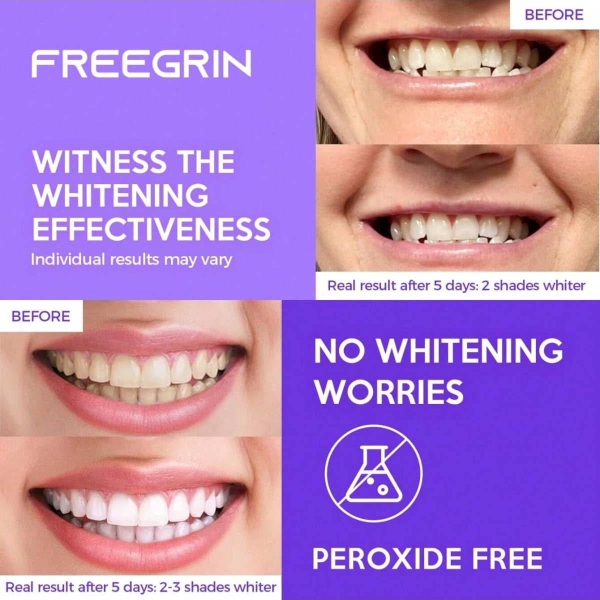 Autocollants de blanchiment de - Teeth Whitening Gel Refills avis et prix
